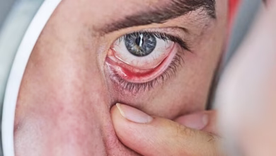 Black spots in front of eyes? It could be eye cancer, know 8 warning signs