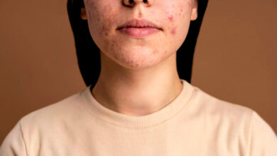 5 signs on the face that tell that your health is deteriorating
