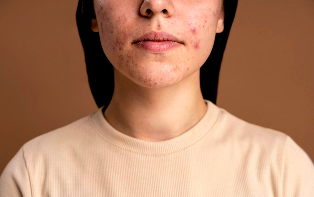 5 signs on the face that tell that your health is deteriorating