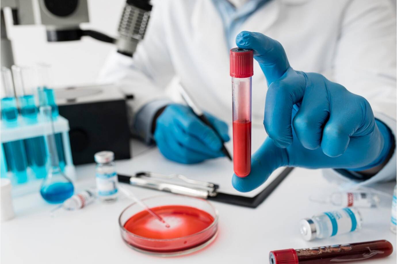 Detect diseases in time: These 9 blood tests will save your time and health