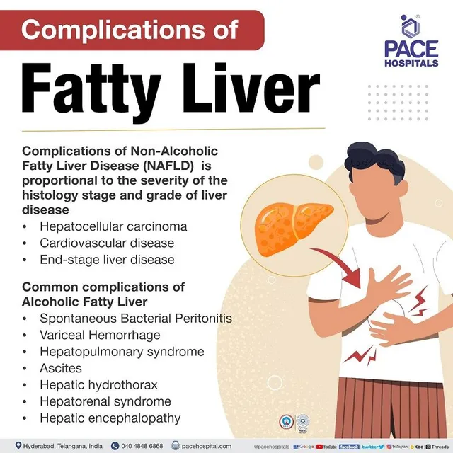 These 5 symptoms of fatty liver are found only in women, the risk may increase