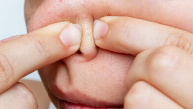 Dermatologists keep this thing away from home, know why