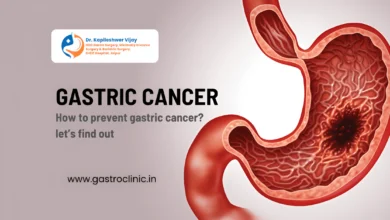 Why is gastric cancer increasing in India? Know the prevention