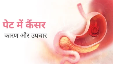 Stomach cancer in young age: Recognize the symptoms and prevent it