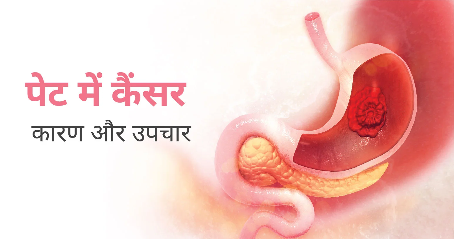 Stomach cancer in young age: Recognize the symptoms and prevent it